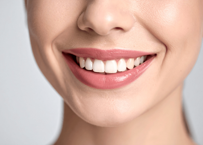 Diseño de Sonrisa