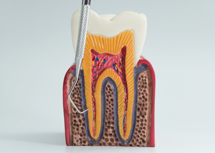 Endodoncia