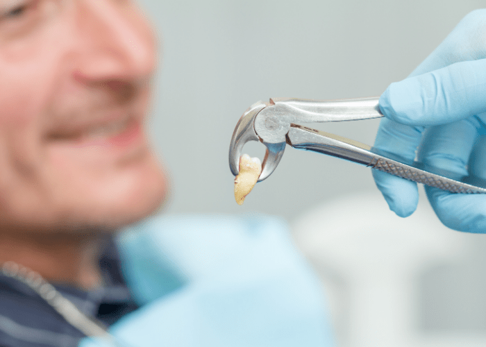 Extracciones dentales