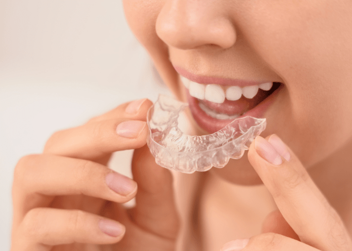 Guarda oclusal